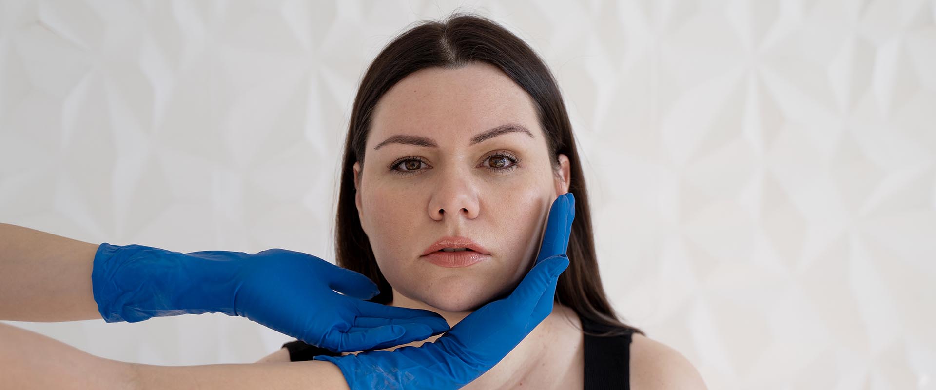 Liposucción de cuello