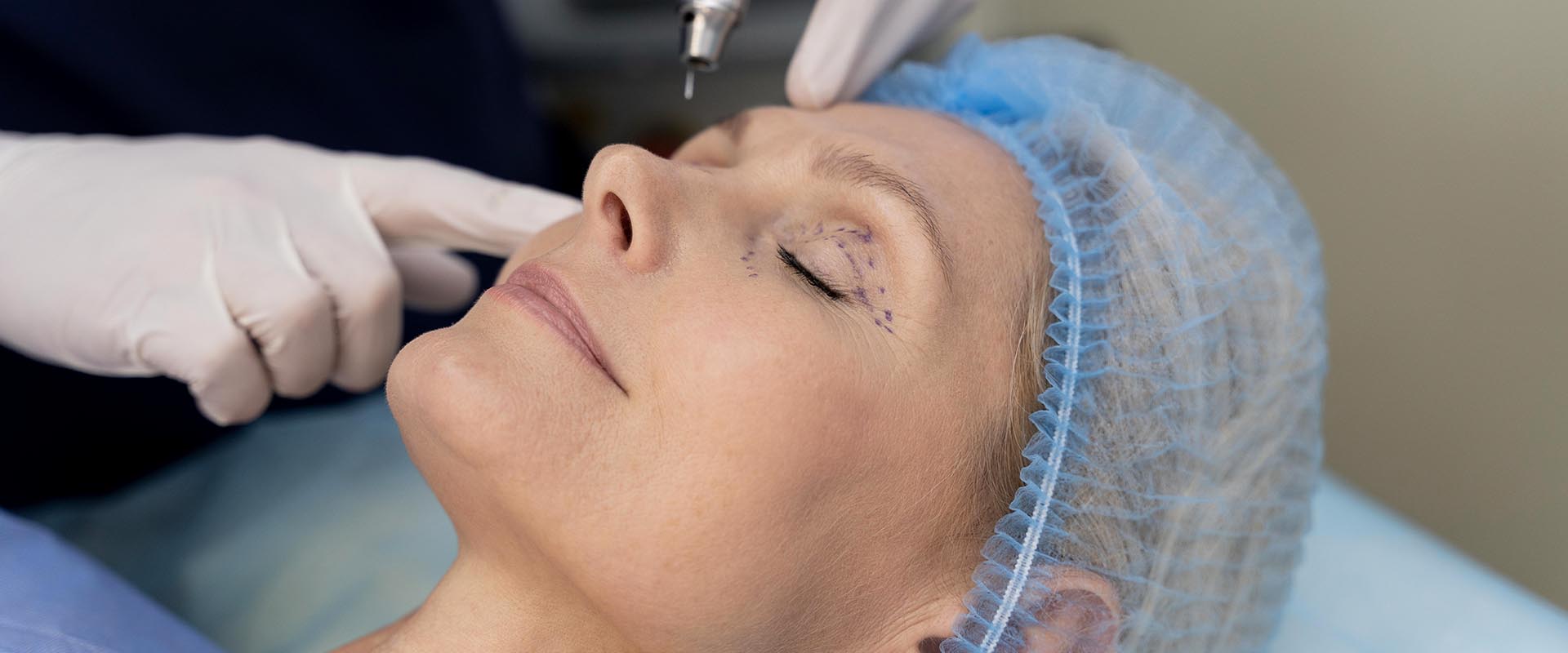 Rinoplastia ultrasónica