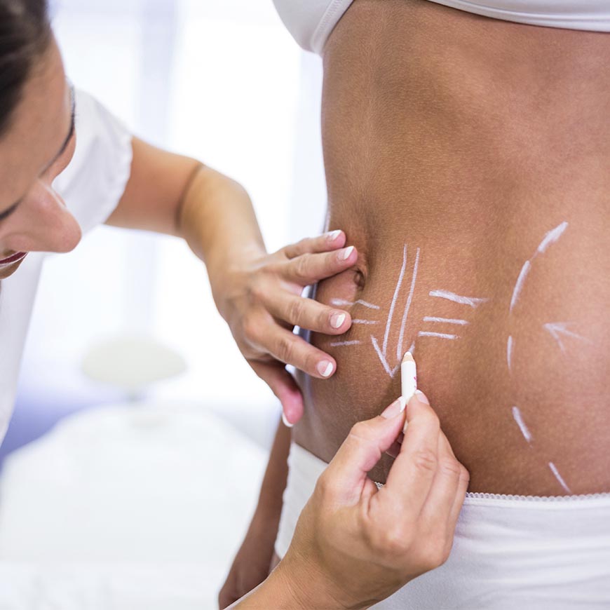 Franklin Alvear Cirujano Plástico